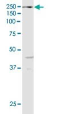 Western Blot: KDM6A Antibody (4E7) [H00007403-M05] - Analysis of KDM6A expression in IMR-32.