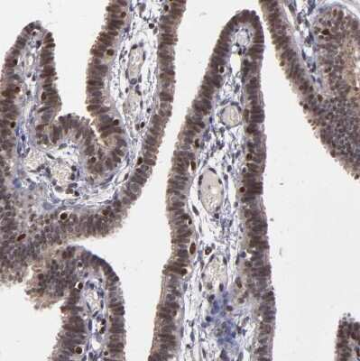 Immunohistochemistry-Paraffin: KDM6A Antibody [NBP1-80628] - Staining of human Fallopian tube shows moderate  nuclear positivity in glandular cells.