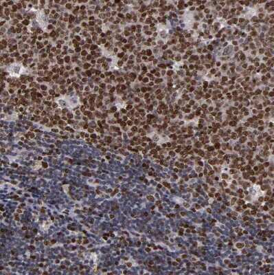 Immunohistochemistry-Paraffin: KDM6A Antibody [NBP1-80628] - Staining of human lymph node shows moderate to strong nuclear positivity in germinal center cells.