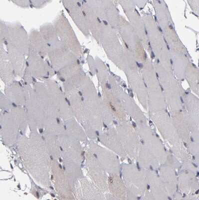 Immunohistochemistry-Paraffin: KDM6A Antibody [NBP1-80628] - Staining of human skeletal muscle shows no positivity in myocytes as expected.