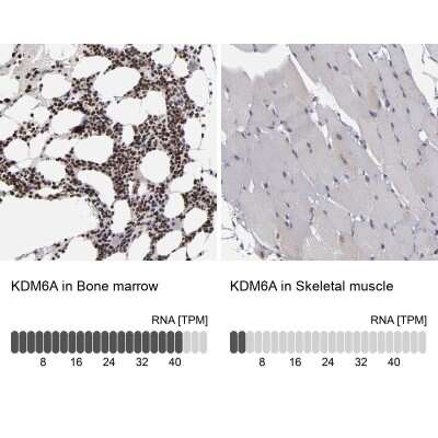 Immunohistochemistry-Paraffin KDM6A Antibody