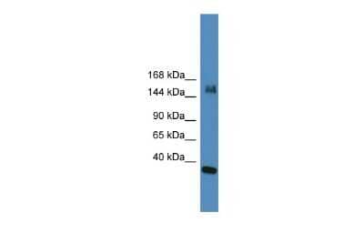 Western Blot: KDM6A Antibody [NBP2-87671] - WB Suggested Anti-UTX Antibody Titration: 0.2-1 ug/ml. ELISA Titer: 1:1562500. Positive Control: Hela cell lysate