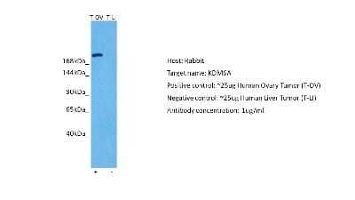 Western Blot: KDM6A Antibody [NBP2-87672] - Host: Rabbit. Target: KDM6A. Positive control (+): Human Ovary (OV). Negative control (-): Human liver (LI). Antibody concentration: 1ug/ml