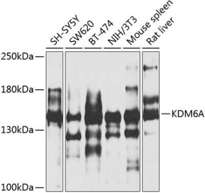 Western Blot: KDM6A Antibody [NBP3-05103] - Analysis of extracts of various cell lines, using KDM6A antibody at 1:1000 dilution. Secondary antibody: HRP Goat Anti-Rabbit IgG (H+L) at 1:10000 dilution. Lysates/proteins: 25ug per lane. Blocking buffer: 3% nonfat dry milk in TBST. Detection: ECL Basic Kit