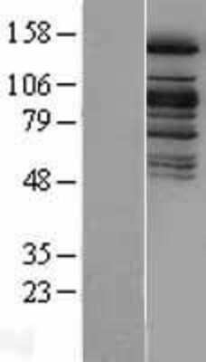 Western Blot KDM6A Overexpression Lysate