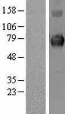 Western Blot: KEAP1 Overexpression Lysate (Adult Normal) [NBL1-12225] Left-Empty vector transfected control cell lysate (HEK293 cell lysate); Right -Over-expression Lysate for KEAP1.