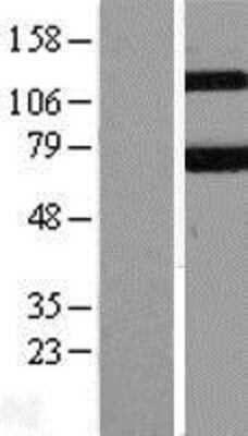 Western Blot: KEAP1 Overexpression Lysate (Adult Normal) [NBL1-12226] Left-Empty vector transfected control cell lysate (HEK293 cell lysate); Right -Over-expression Lysate for KEAP1.