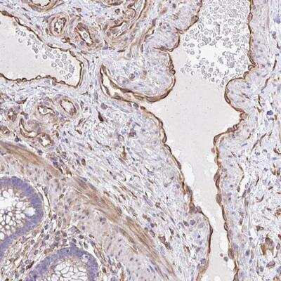 Immunohistochemistry-Paraffin: KF1 Antibody [NBP2-31700] - Staining of human colon shows strong cytoplasmic positivity in endothelial cells.