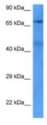 Western Blot: KF1 Antibody [NBP3-09986] - Western blot analysis of KF1 in Breast Tumor lysates. Antibody dilution at 1ug/ml