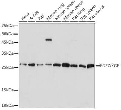 Western Blot: KGF/FGF-7 Antibody (4L2O8) [NBP3-16623] - Western blot analysis of extracts of various cell lines, using FGF7/KGF/FGF-7 Rabbit mAb (NBP3-16623) at 1:1000 dilution. Secondary antibody: HRP Goat Anti-Rabbit IgG (H+L) at 1:10000 dilution. Lysates/proteins: 25ug per lane. Blocking buffer: 3% nonfat dry milk in TBST. Detection: ECL Basic Kit. Exposure time: 60s.