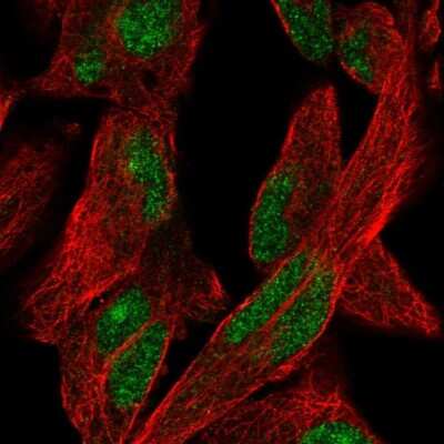 Immunocytochemistry/Immunofluorescence: KGF/FGF-7 Antibody [NBP1-91898] - Staining of human cell line RH-30 shows localization to nucleus & nucleoli. Antibody staining is shown in green.