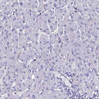 Immunohistochemistry-Paraffin: KGF/FGF-7 Antibody [NBP1-91898] - Staining of human liver shows no positivity in hepatocytes as expected.