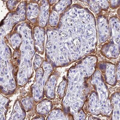 Immunohistochemistry-Paraffin: KGF/FGF-7 Antibody [NBP1-91898] - Staining of human placenta shows strong cytoplasmic and membranous positivity in trophoblastic cells.