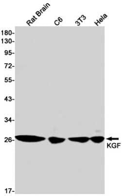 Western Blot: KGF/FGF-7 Antibody (S07-5C6) [NBP3-14948] - Western blot detection of KGF/FGF-7 in Rat Brain, C6, 3T3, Hela cell lysates using KGF/FGF-7 Rabbit mAb (1:1000 diluted). Predicted band size: 23kDa. Observed band size: 28kDa.