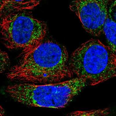 Immunocytochemistry/Immunofluorescence: KHDC1 Antibody [NBP1-88798] - Immunofluorescent staining of human cell line A-431 shows localization to cytosol & mitochondria.