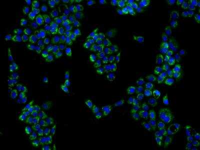 Immunocytochemistry/Immunofluorescence: KHDC1 Antibody [NBP3-06228] - Immunofluorescence staining of KHDC1 in A431 cells. Cells were fixed with 4% PFA, permeabilzed with 0.1% Triton X-100 in PBS,blocked with 10% serum, and incubated with rabbit anti-Human KHDC1 polyclonal antibody (dilution ratio 1:200) at 4C overnight. Then cells were stained with the Alexa Fluor(R)488-conjugated Goat Anti-rabbit IgG secondary antibody (green) and counterstained with DAPI (blue).Positive staining was localized to Cytoplasm.