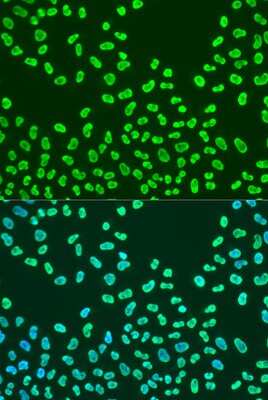 Immunocytochemistry/Immunofluorescence: KHDRBS2 Antibody [NBP3-03932] - Analysis of U2OS cells using KHDRBS2 antibody at dilution of 1:100. Blue: DAPI for nuclear staining.