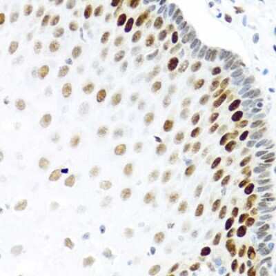 Immunohistochemistry-Paraffin: KHDRBS2 Antibody [NBP3-03933] - Paraffin-embedded human esophagus using KHDRBS2 antibody at dilution of 1:100 (40x lens).