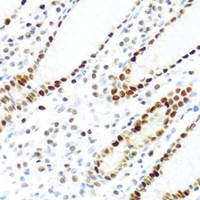 Immunohistochemistry-Paraffin: KHDRBS2 Antibody [NBP3-03933] - Paraffin-embedded human stomach using KHDRBS2 antibody at dilution of 1:100 (40x lens).