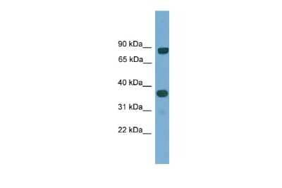 Western Blot: KHDRBS2 Antibody [NBP2-87678] - WB Suggested Anti-KHDRBS2 Antibody Titration: 0.2-1 ug/ml. ELISA Titer: 1:312500. Positive Control: Human Lung