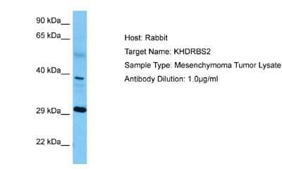 Western Blot: KHDRBS2 Antibody [NBP2-87679] - Host: Rabbit. Target Name: KHDRBS2. Sample Tissue: Human Mesenchymoma Tumor lysates. Antibody Dilution: 1ug/ml