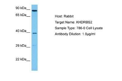 Western Blot: KHDRBS2 Antibody [NBP2-87680] - Host: Rabbit. Target Name: KHDRBS2. Sample Tissue: Human 786-0 Whole Cell lysates. Antibody Dilution: 1ug/ml