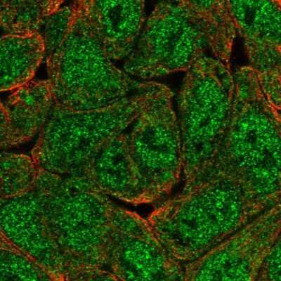 Immunocytochemistry/Immunofluorescence: KHNYN Antibody [NBP1-81514] - Immunofluorescent staining of human cell line RT4 shows localization to nucleoplasm, cytosol & aggresome.