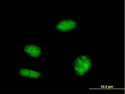 Immunocytochemistry/Immunofluorescence: KHSRP Antibody (2F3) [H00008570-M03] - Analysis of monoclonal antibody to KHSRP on HeLa cell. Antibody concentration 10 ug/ml