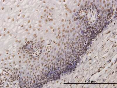 Immunohistochemistry-Paraffin: KHSRP Antibody (4H7) [H00008570-M09] - Analysis of monoclonal antibody to KHSRP on formalin-fixed paraffin-embedded human esophagus. Antibody concentration 3 ug/ml