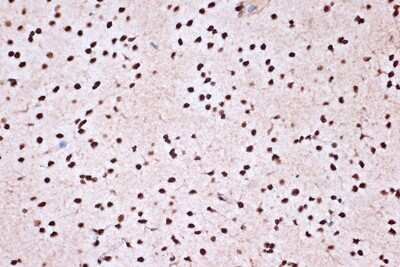 Immunohistochemistry-Paraffin: KHSRP Antibody (4V4O1) [NBP3-16746] - Immunohistochemistry of paraffin-embedded rat brain using KHSRP Rabbit mAb (NBP3-16746) at dilution of 1:100 (40x lens).Perform microwave antigen retrieval with 10 mM Tris/EDTA buffer pH 9.0 before commencing with IHC staining protocol.