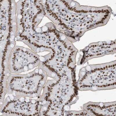 Immunohistochemistry-Paraffin: KHSRP Antibody [NBP1-84719] - Staining of human duodenum shows strong nuclear positivity in glandular cells.