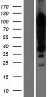 Western Blot: KHSRP Overexpression Lysate (Adult Normal) [NBP2-07966] Left-Empty vector transfected control cell lysate (HEK293 cell lysate); Right -Over-expression Lysate for KHSRP.