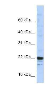 Western Blot KIAA0040 Antibody - BSA Free