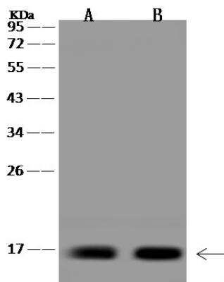 Western Blot: KIAA0040 Antibody [NBP3-12664] - Lane A: RT4 Whole Cell LysateLane B: MDA-MB-453 Whole Cell LysateLysates/proteins at 30 ug per lane.SecondaryGoat Anti-Rabbit IgG (H+L)/HRP at 1/10000 dilution.Developed using the ECL technique.Performed under reducing conditions.Predicted band size:15 kDaObserved band size:15 kDa