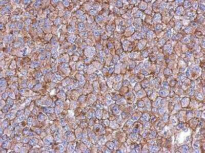 Immunohistochemistry-Paraffin: KIAA0090 Antibody [NBP2-17044] - Immunohistochemical analysis of paraffin-embedded H1299 xenograft, using antibody at 1:500 dilution.