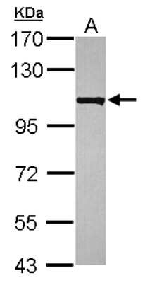 Western Blot EMC1 Antibody