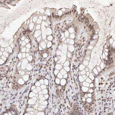 Immunohistochemistry-Paraffin BICRAL Antibody - BSA Free