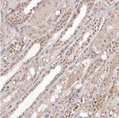 Immunohistochemistry-Paraffin BICRAL Antibody - BSA Free