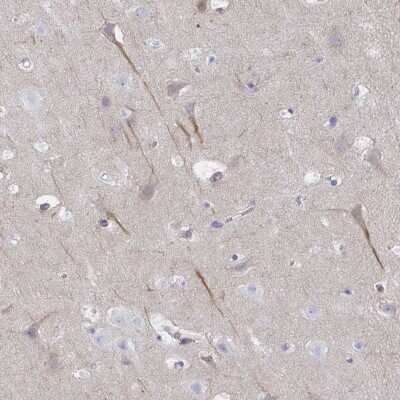 Immunohistochemistry-Paraffin: KIAA0284 Antibody [NBP2-31739] - Staining of human cerebral cortex shows moderate cytoplasmic positivity in neuronal cells.