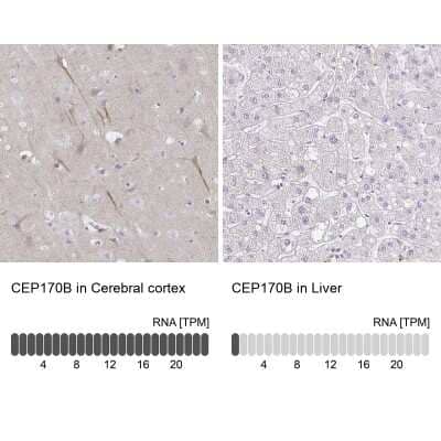 Immunohistochemistry-Paraffin: KIAA0284 Antibody [NBP2-31739] - Staining in human cerebral cortex and liver tissues using anti-CEP170B antibody. Corresponding CEP170B RNA-seq data are presented for the same tissues.