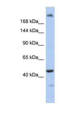 Western Blot: KIAA0284 Antibody [NBP1-79577] - Human Muscle lysate, concentration 0.2-1 ug/ml.