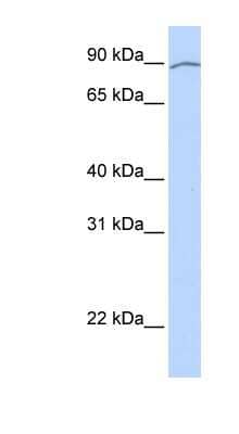 Western Blot: AREL1 Antibody [NBP1-59393] -  Titration: 0.2-1 ug/ml, Positive Control: Human heart.