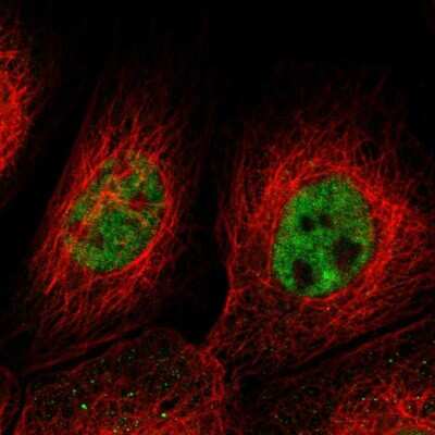 Immunocytochemistry/Immunofluorescence: KIAA0355 Antibody [NBP1-90943] - Immunofluorescent staining of human cell line A-431 shows localization to nucleoplasm. Antibody staining is shown in green.
