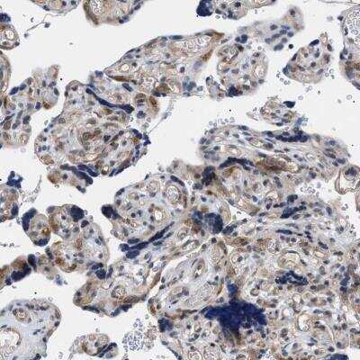 Immunohistochemistry-Paraffin: KIAA0355 Antibody [NBP1-90943] - Staining of human placenta shows moderate cytoplasmic positivity in trophoblastic cells.