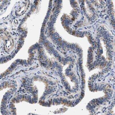 Immunohistochemistry-Paraffin: KIAA0355 Antibody [NBP1-90943] - Staining of human Fallopian tube shows weak cytoplasmic positivity in glandular cells.