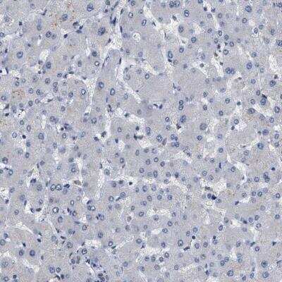 Immunohistochemistry-Paraffin: KIAA0355 Antibody [NBP1-90943] - Staining of human liver shows no positivity in hepatocytes as expected.