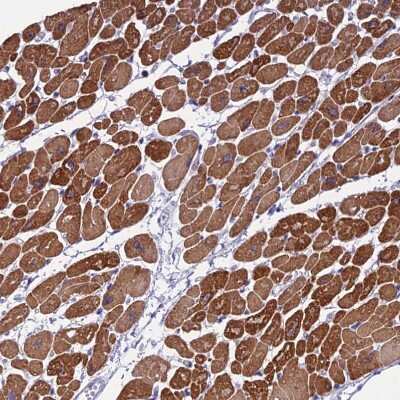 Immunohistochemistry-Paraffin KIAA0408 Antibody - BSA Free