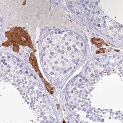 Immunohistochemistry-Paraffin KIAA0408 Antibody - BSA Free