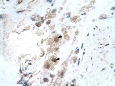Immunohistochemistry-Paraffin: KIAA0494 Antibody [NBP1-59967] - Human Placenta Decidual cells (indicated with arrows), 4-8ug/ml.