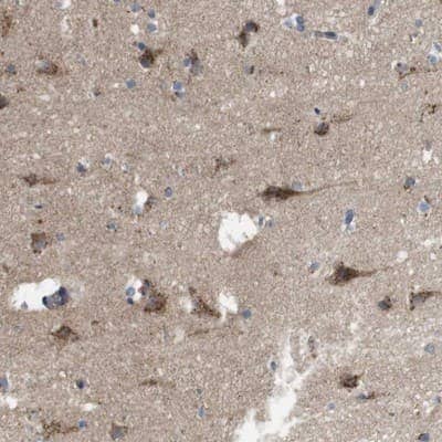 Immunohistochemistry-Paraffin: KIAA0494 Antibody [NBP1-86098] - Staining of human cerebral cortex shows strong cytoplasmic positivity in granular pattern in neuronal cells.